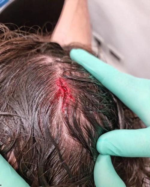 脑袋受伤图片,视觉冲击下的生命警示