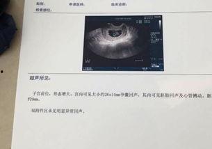 怀孕7个月宝宝图片,见证生命奇迹的瞬间